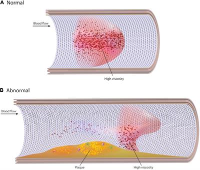 Non-Newtonian Endothelial Shear Stress Simulation: Does It Matter?